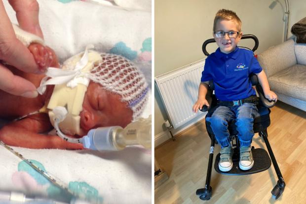 Left: Charlie after he was born premature. Right: Charlie in his wheelchair