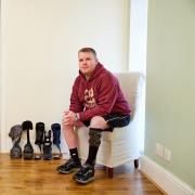 Help for Heroes ambassador and former army medic Tony Williams with a funded leg brace